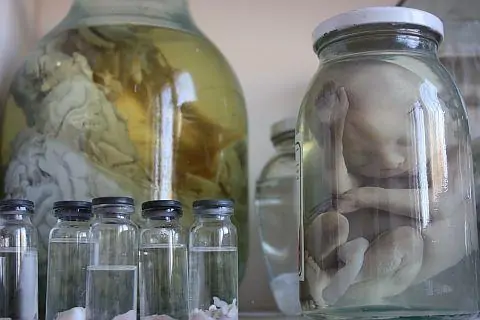 Человеческие эмбрионы, учебные пособия для молодых ординаторов