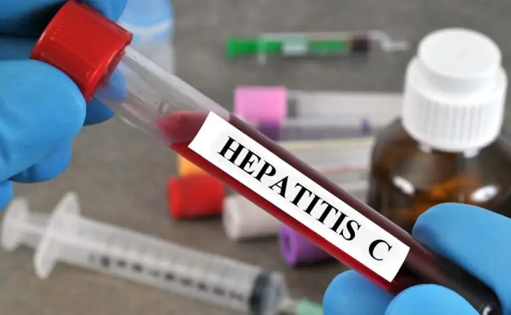 Больше всего гепатитом С заражаются городские жители. Фото hemophilia.ru