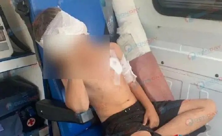 Пострадавший мальчик. Фото Donday